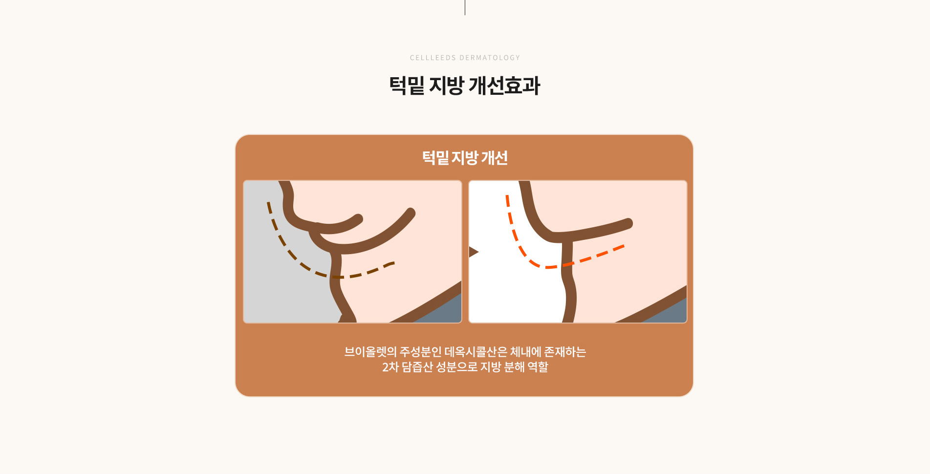 옴므브이올렛 개선효과