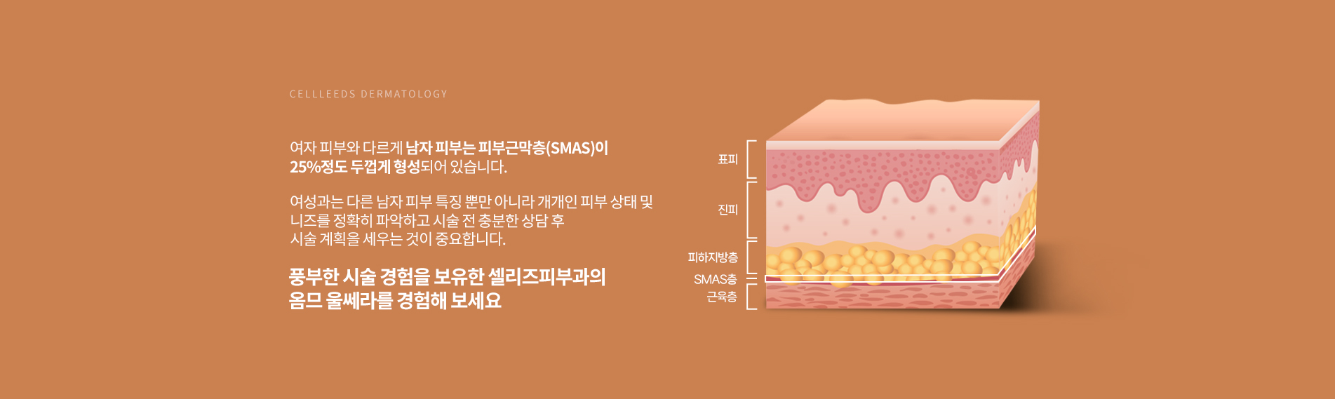 옴므울쎄라 이유