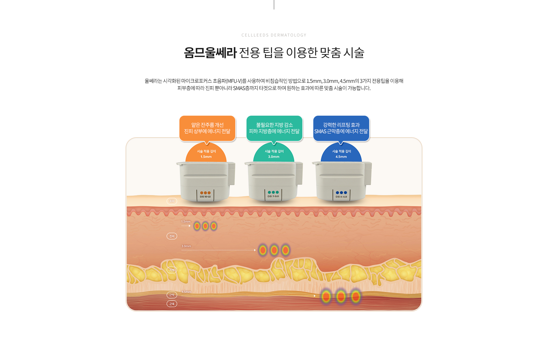 옴므울쎄라 전용팁