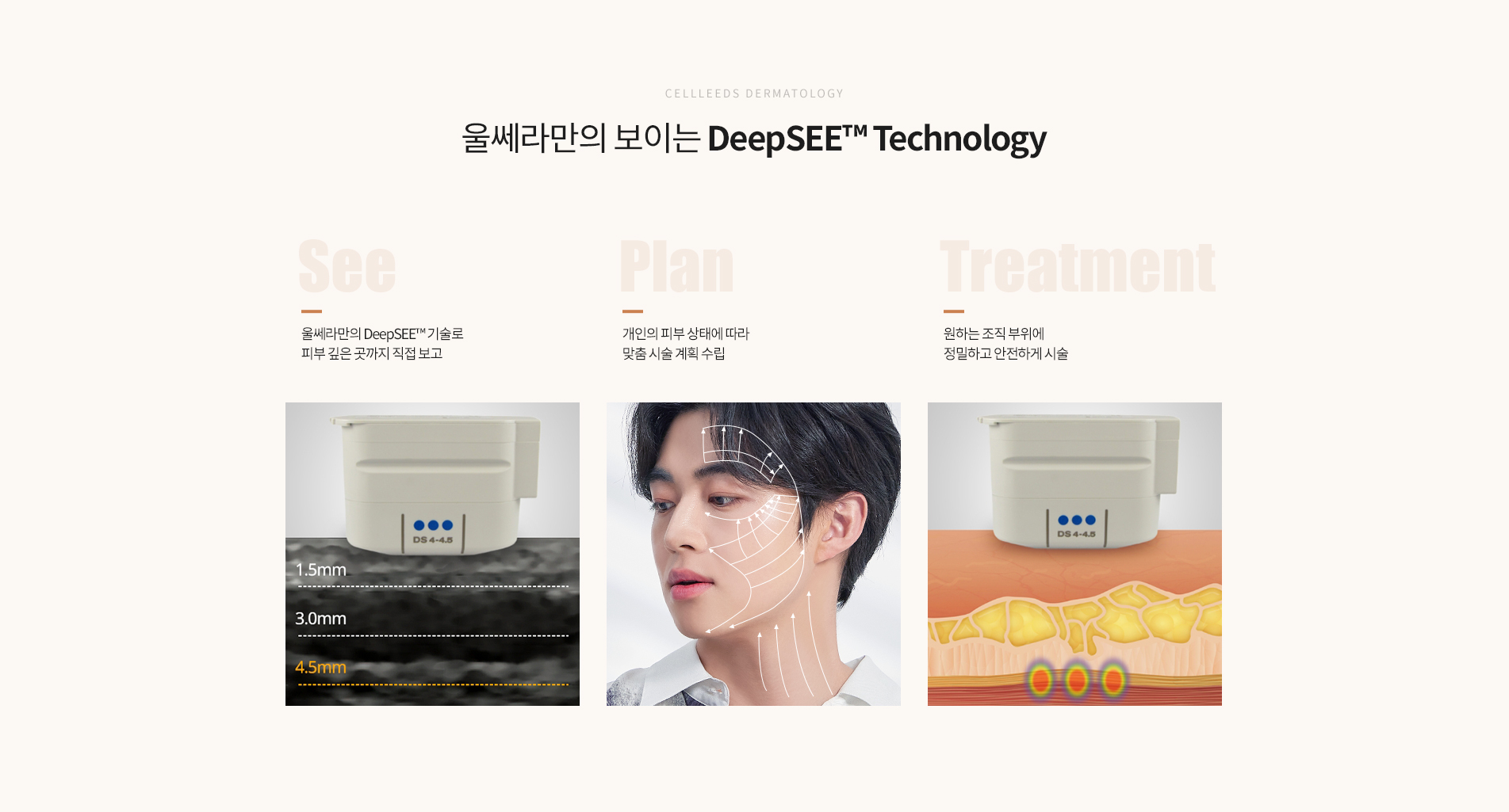 옴므울쎄라 기술