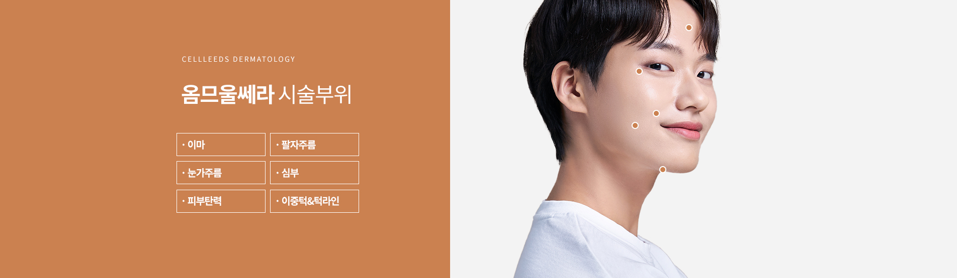 옴므울쎄라 시술부위