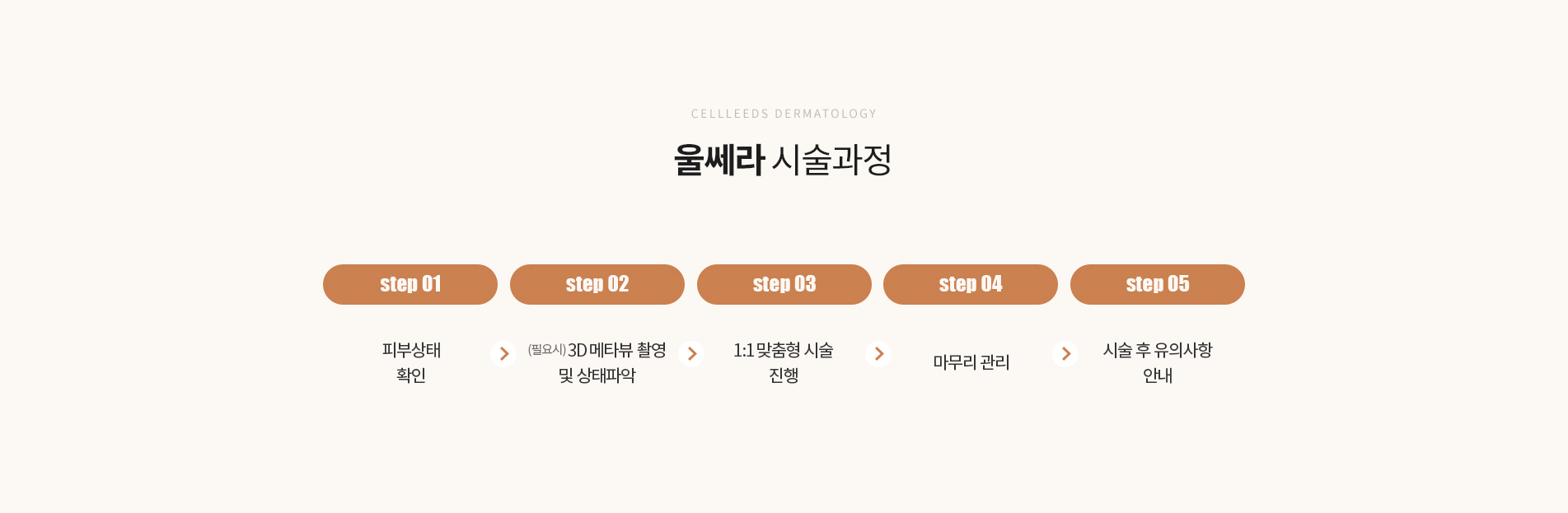 옴므울쎄라 시술과정