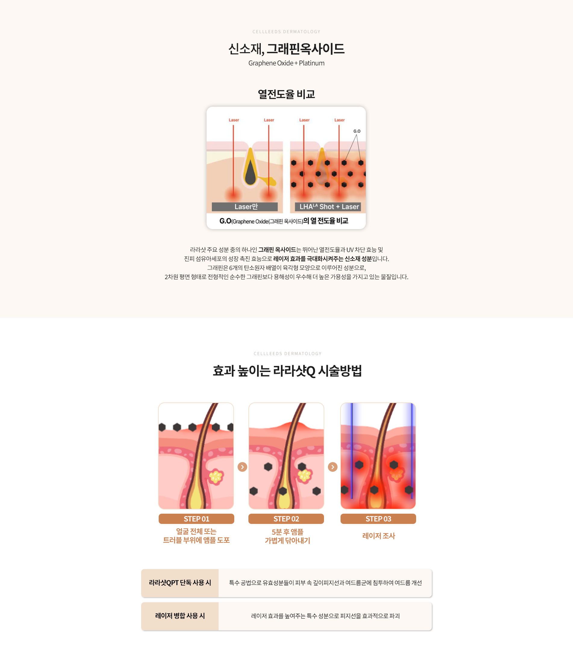 라라샷QPT 시술방법