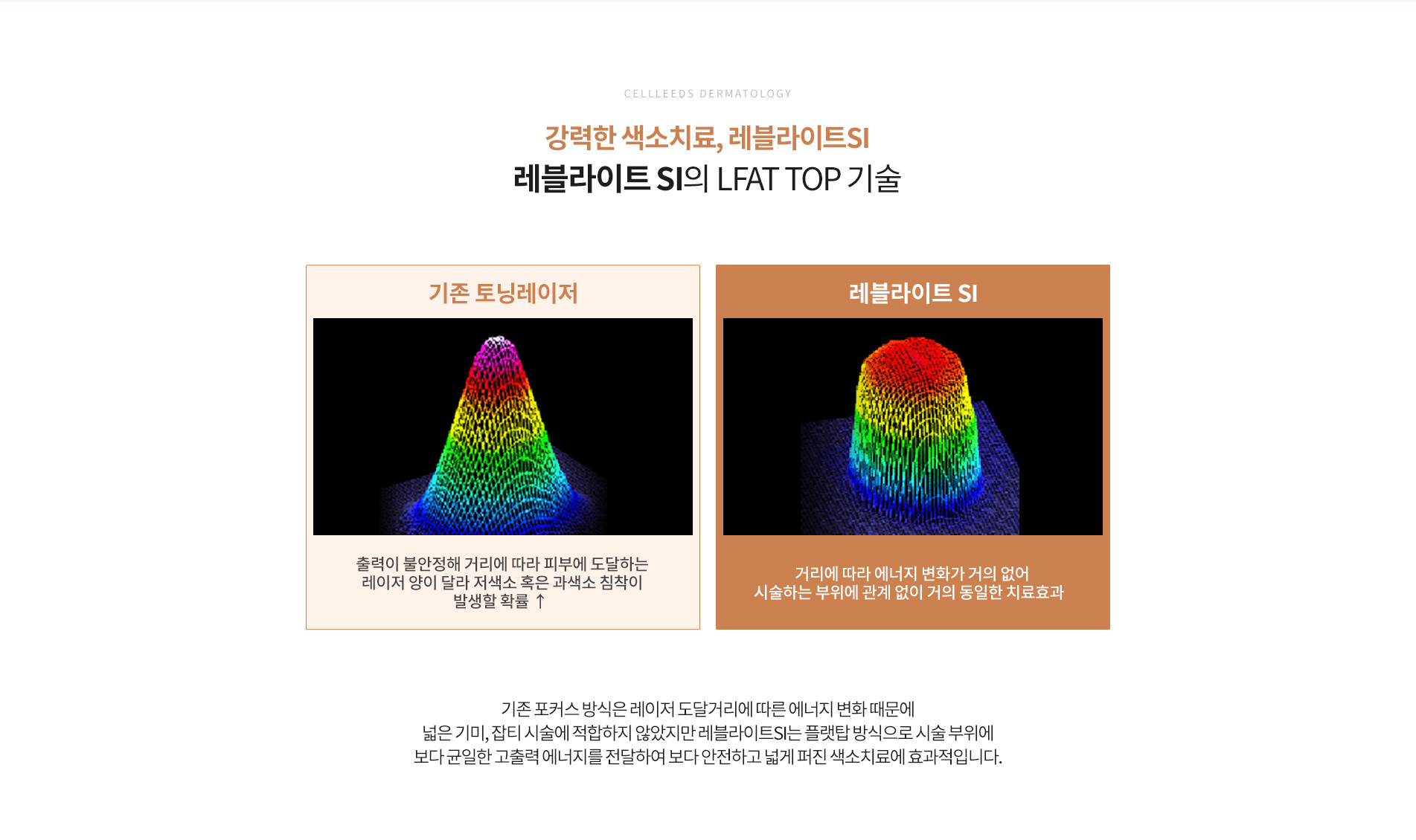 레블라이트 si 기존 레이저와의 차이점
