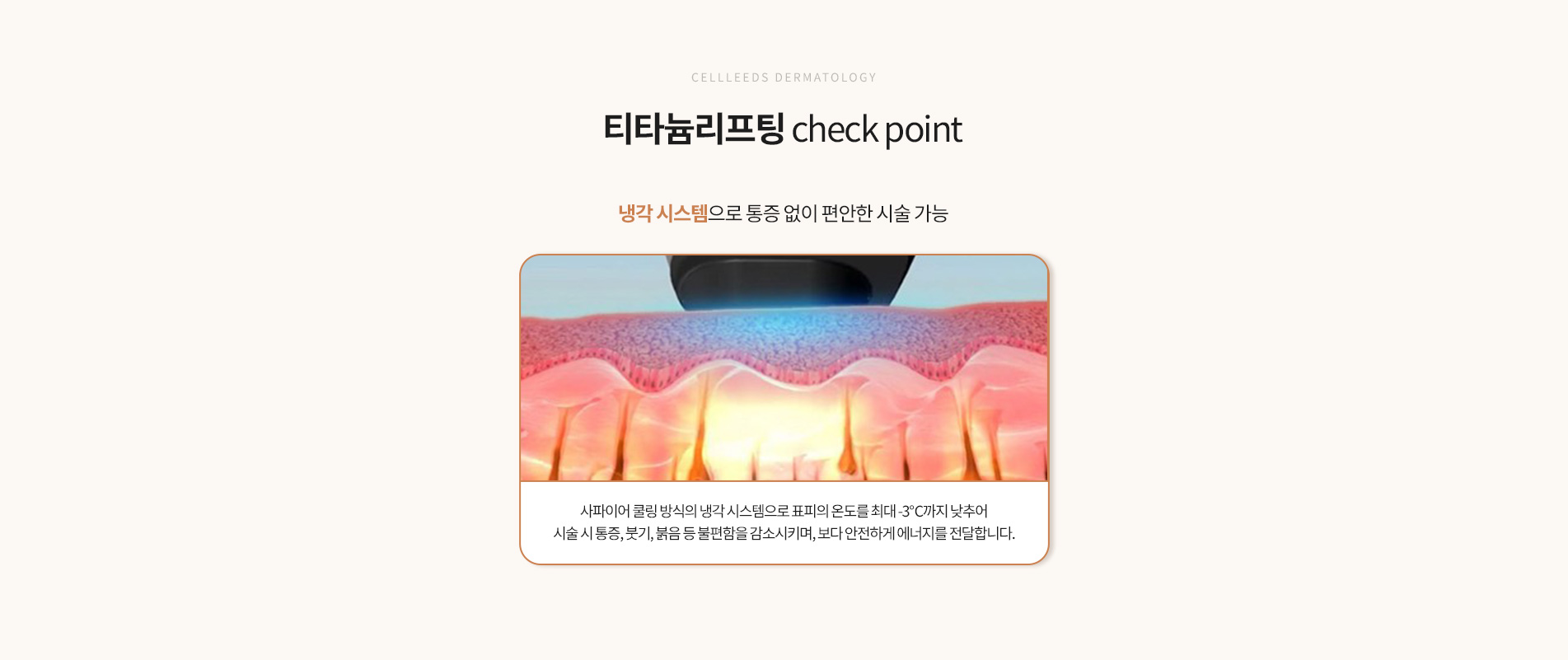 티타늄리프팅 체크포인트