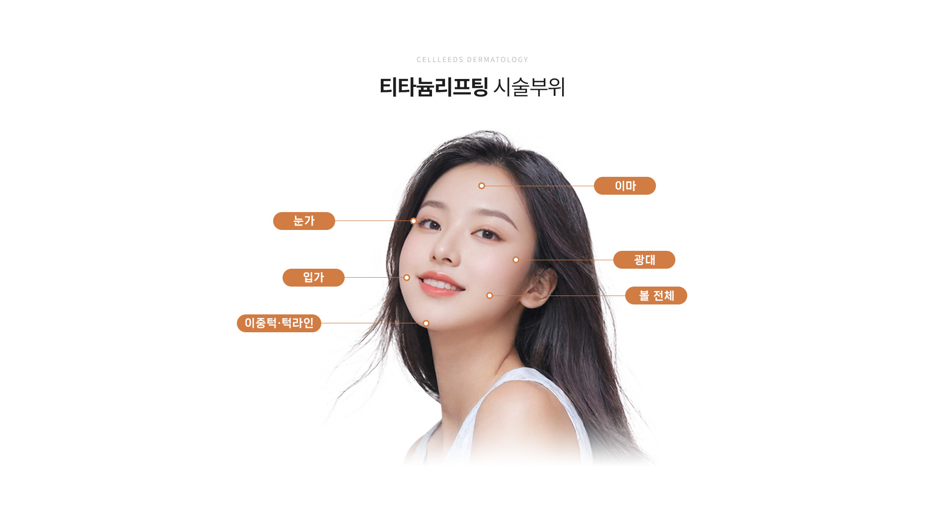 티타늄리프팅 시술부위