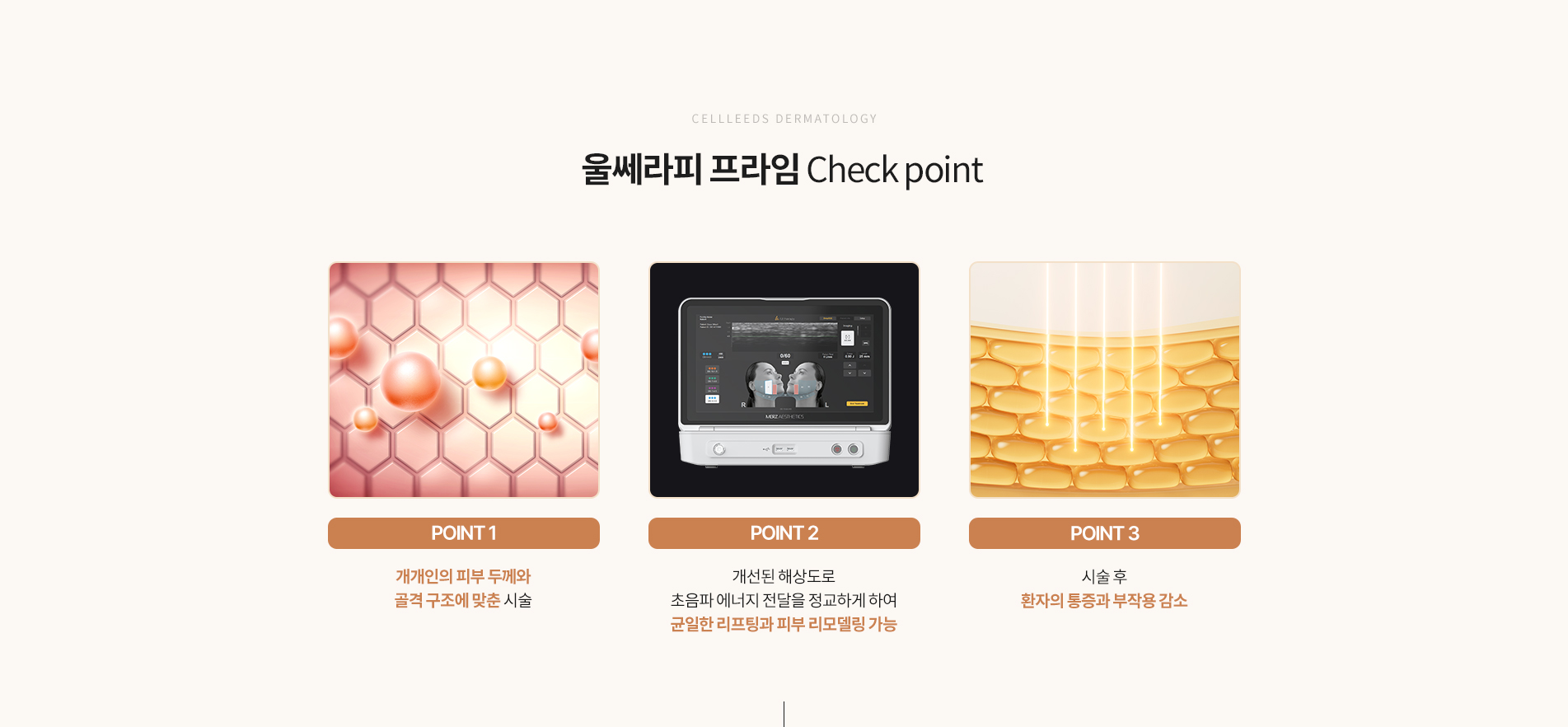 울쎄라피 프라임 체크포인트