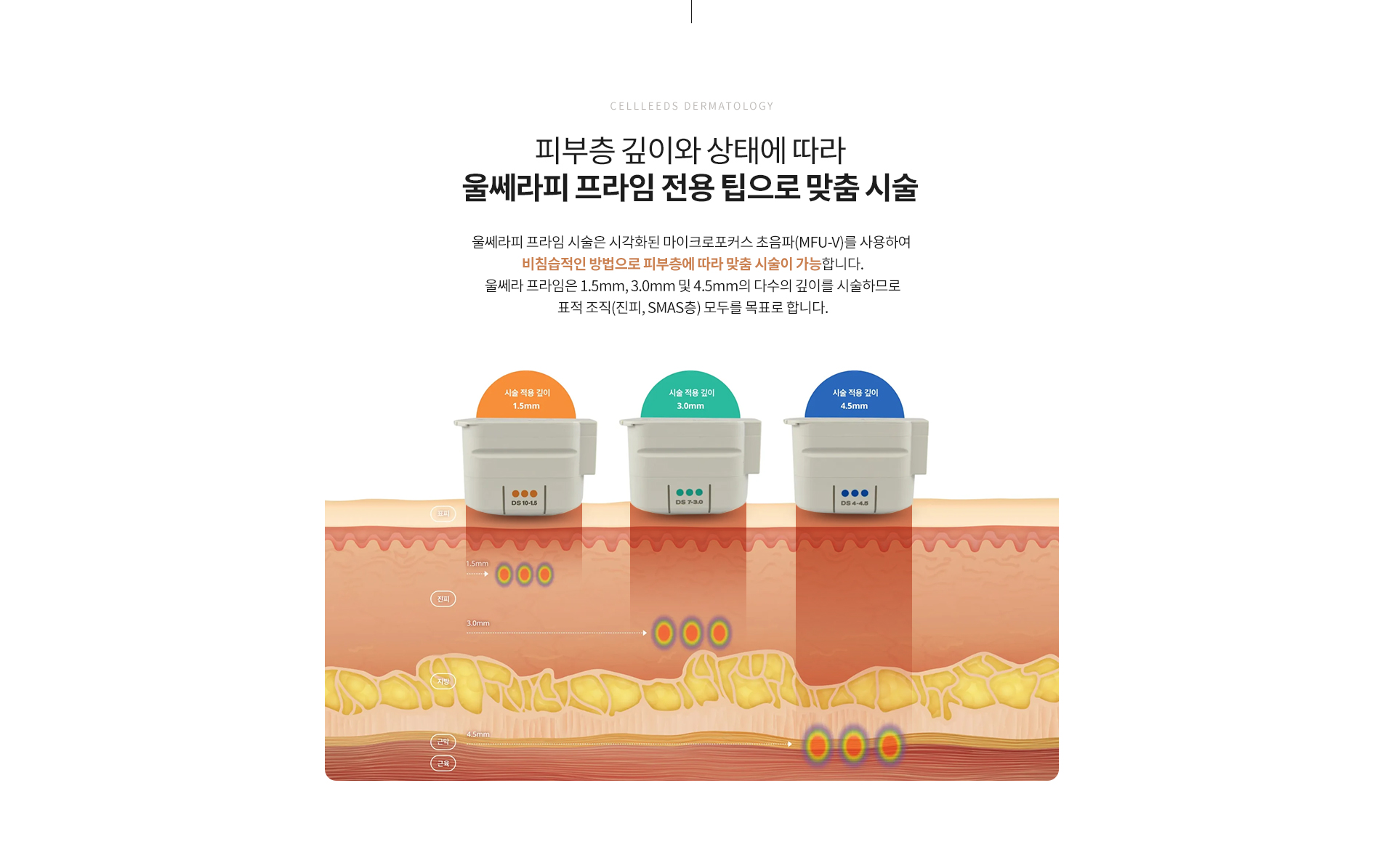 울쎄라피 프라임 전용팁